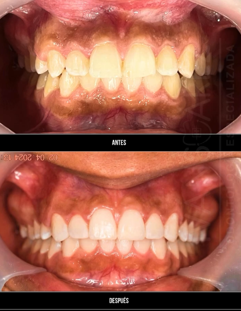 Diseño de Sonrisa
